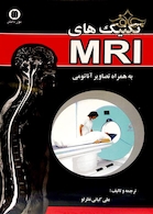 تکنیک هایMRI کیانی نظرلو